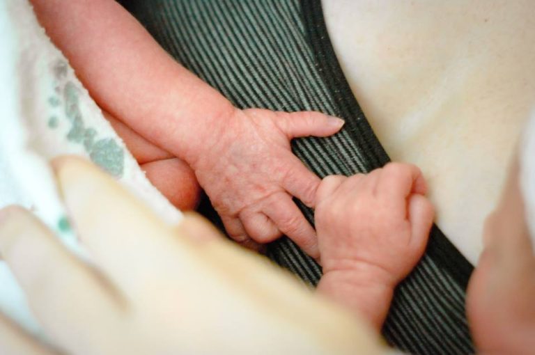 Karin Rambo of Truncationblog.com shares her twin birth story