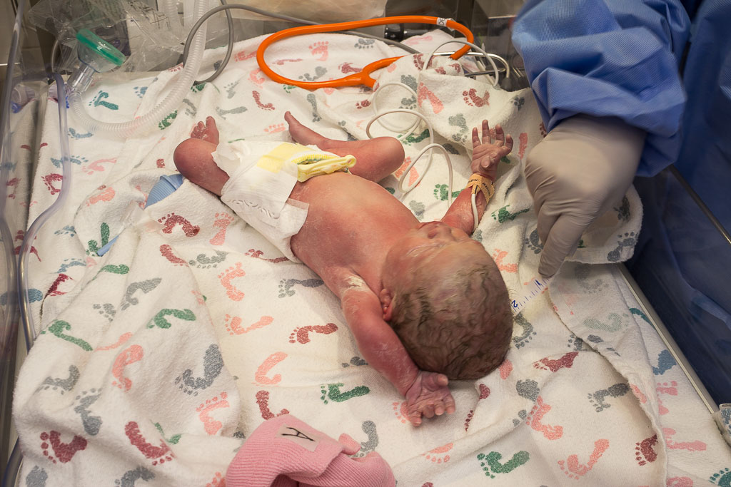 Elanor and Rose: a Twin Birth Story Karin Rambo of Truncationblog.com shares her twin birth story